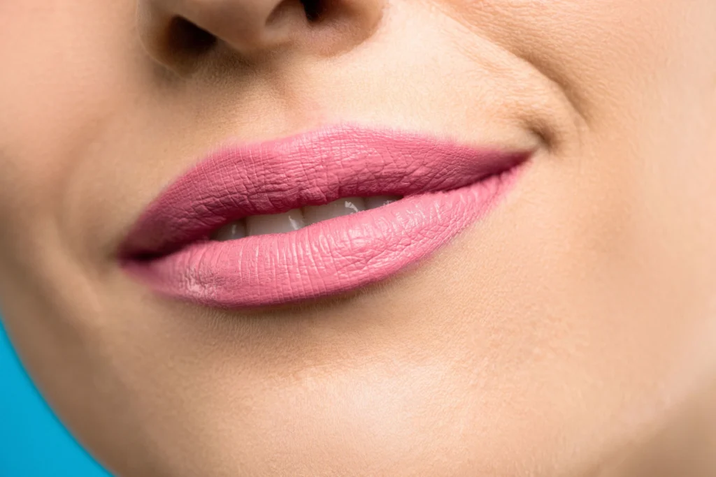 Lip Lines & Thinning Lips 2 lip lines